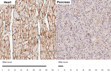 Anti-Integrin beta 1 / CD29 antibody [HL3715] used in IHC (Paraffin sections) (IHC-P). GTX641905