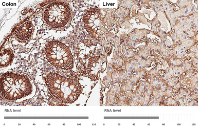 Anti-Integrin beta 1 / CD29 antibody [HL3715] used in IHC (Paraffin sections) (IHC-P). GTX641905