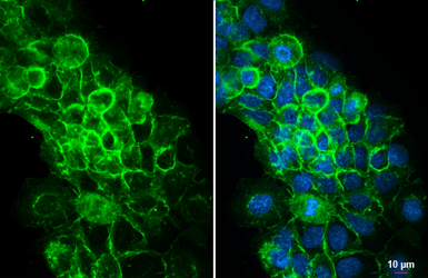 Anti-Integrin beta 1 / CD29 antibody [HL3716] used in Immunocytochemistry/ Immunofluorescence (ICC/IF). GTX641906