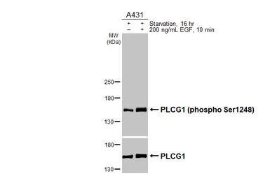 Anti-PLCG1 (phospho Ser1248) antibody [HL3719] used in Western Blot (WB). GTX641909