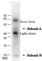 Anti-Verotoxin / Shiga toxin (SLT-1 + SLT-2) antibody used in Immunoprecipitation (IP). GTX64191