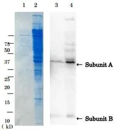 Anti-Verotoxin / Shiga toxin (SLT-1 + SLT-2) antibody used in Western Blot (WB). GTX64191