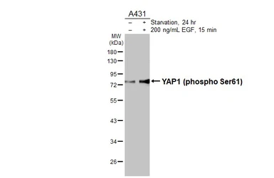 Anti-YAP1 (phospho Ser61) antibody [HL3721] used in Western Blot (WB). GTX641911