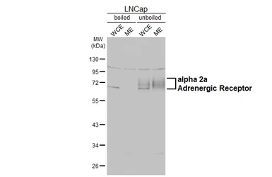 Anti-alpha 2a Adrenergic Receptor antibody [HL3723] used in Western Blot (WB). GTX641913