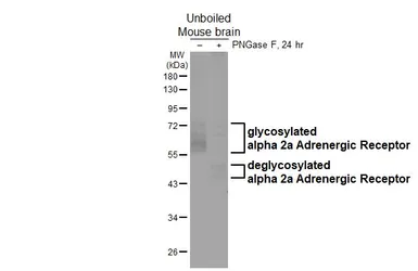 Anti-alpha 2a Adrenergic Receptor antibody [HL3723] used in Western Blot (WB). GTX641913