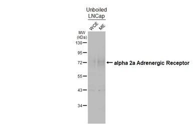 Anti-alpha 2a Adrenergic Receptor antibody [HL3725] used in Western Blot (WB). GTX641915