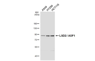 Anti-LSD2 / AOF1 antibody [HL3728] used in Western Blot (WB). GTX641918