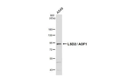 Anti-LSD2 / AOF1 antibody [HL3729] used in Western Blot (WB). GTX641919