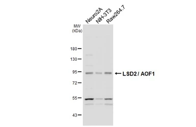 Anti-LSD2 / AOF1 antibody [HL3729] used in Western Blot (WB). GTX641919