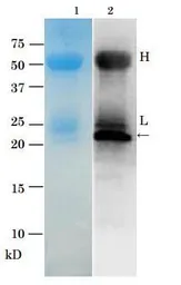 Anti-Vibrio parahaemolyticus TRH Toxin antibody used in Immunoprecipitation (IP). GTX64192