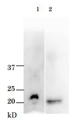 Anti-Vibrio parahaemolyticus TRH Toxin antibody used in Western Blot (WB). GTX64192