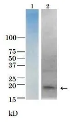 Anti-Vibrio parahaemolyticus TRH Toxin antibody used in Western Blot (WB). GTX64192