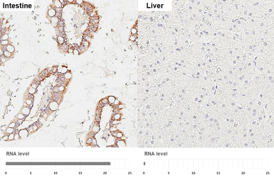 Anti-HKDC1 antibody [HL3743] used in IHC (Paraffin sections) (IHC-P). GTX641933