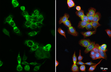Anti-HKDC1 antibody [HL3743] used in Immunocytochemistry/ Immunofluorescence (ICC/IF). GTX641933