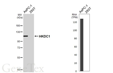 Anti-HKDC1 antibody [HL3743] used in Western Blot (WB). GTX641933