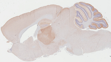 Anti-GABA B Receptor 1 antibody [GT83] used in IHC (Paraffin sections) (IHC-P). GTX641938
