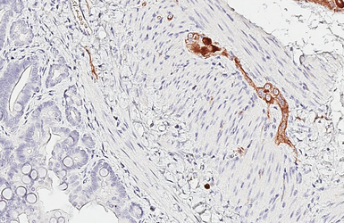 Anti-GABA B Receptor 1 antibody [GT83] used in IHC (Paraffin sections) (IHC-P). GTX641938
