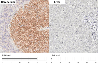 Anti-GABA B Receptor 1 antibody [GT83] used in IHC (Paraffin sections) (IHC-P). GTX641938