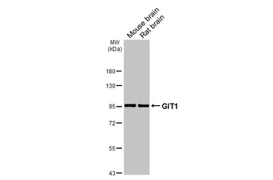 Anti-GIT1 antibody [GT87] used in Western Blot (WB). GTX641942