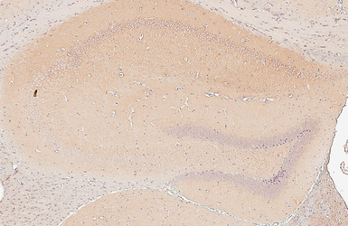 Anti-GIT1 antibody [GT87] used in IHC (Paraffin sections) (IHC-P). GTX641942