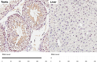 Anti-GIT1 antibody [GT87] used in IHC (Paraffin sections) (IHC-P). GTX641942