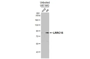 Anti-LRRC15 antibody [HL3750] used in Western Blot (WB). GTX641949