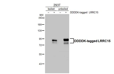Anti-LRRC15 antibody [HL3750] used in Western Blot (WB). GTX641949