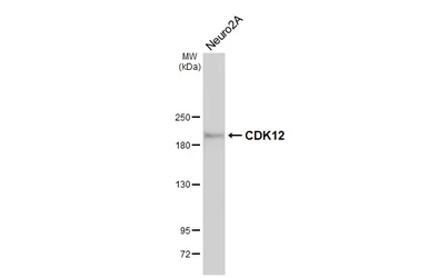 Anti-CDK12 antibody [HL3757] used in Western Blot (WB). GTX641956