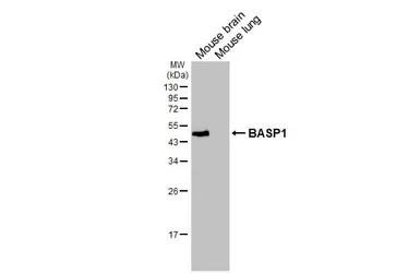 Anti-BASP1 antibody [HL3760] used in Western Blot (WB). GTX641959