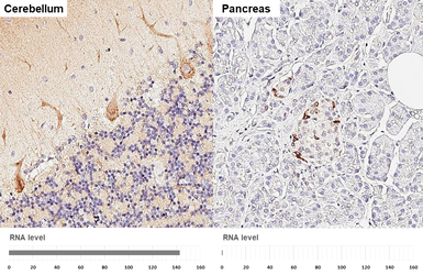 Anti-BASP1 antibody [HL3760] used in IHC (Paraffin sections) (IHC-P). GTX641959
