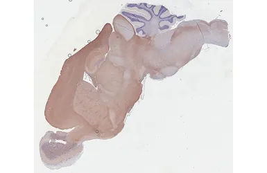 Anti-BASP1 antibody [HL3760] used in IHC (Paraffin sections) (IHC-P). GTX641959