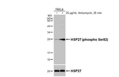 Anti-HSP27 (phospho Ser82) antibody [HL3761] used in Western Blot (WB). GTX641960