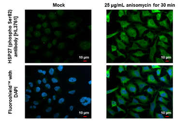 Anti-HSP27 (phospho Ser82) antibody [HL3761] used in Immunocytochemistry/ Immunofluorescence (ICC/IF). GTX641960