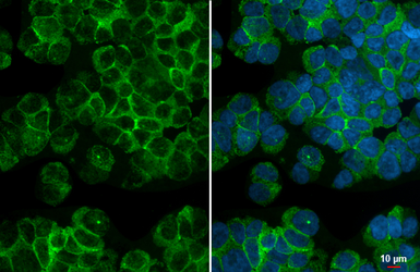 Anti-CX3CR1 antibody [HL3763] used in Immunocytochemistry/ Immunofluorescence (ICC/IF). GTX641962