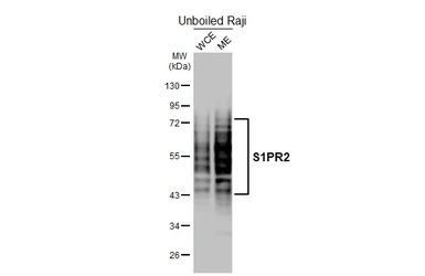Anti-S1PR2 antibody [HL3765] used in Western Blot (WB). GTX641964