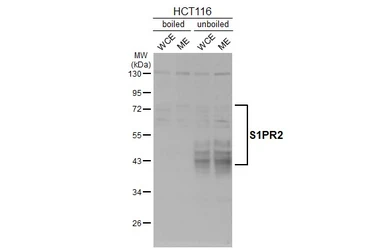 Anti-S1PR2 antibody [HL3765] used in Western Blot (WB). GTX641964