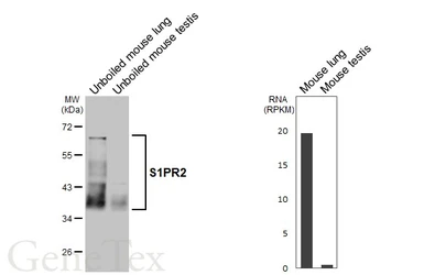 Anti-S1PR2 antibody [HL3765] used in Western Blot (WB). GTX641964