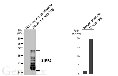 Anti-S1PR2 antibody [HL3765] used in Western Blot (WB). GTX641964