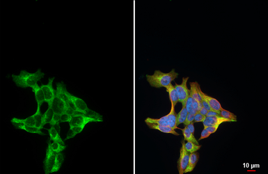 Anti-Procalcitonin antibody [HL3769] used in Immunocytochemistry/ Immunofluorescence (ICC/IF). GTX641968