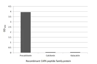 Anti-Procalcitonin antibody [HL3769] used in  (). GTX641968