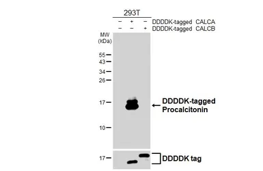 Anti-Procalcitonin antibody [HL3769] used in Western Blot (WB). GTX641968