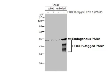 Anti-PAR2 antibody [HL3771] used in Western Blot (WB). GTX641970