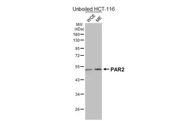 Anti-PAR2 antibody [HL3771] used in Western Blot (WB). GTX641970