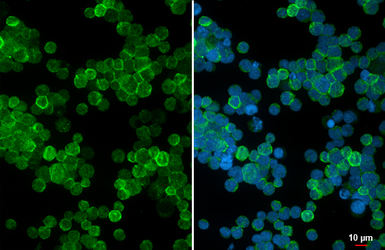Anti-CXCR5 antibody [HL3778] used in Immunocytochemistry/ Immunofluorescence (ICC/IF). GTX641977