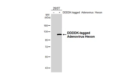 Anti-Adenovirus hexon antibody [HL3779] used in Western Blot (WB). GTX641978