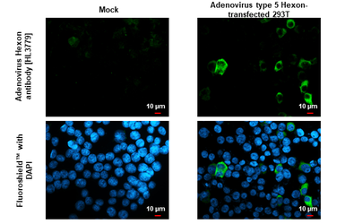 Anti-Adenovirus hexon antibody [HL3779] used in Immunocytochemistry/ Immunofluorescence (ICC/IF). GTX641978