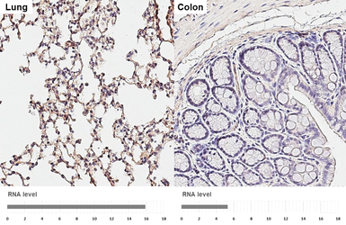 Anti-SH3PXD2A antibody [GT88] used in IHC (Paraffin sections) (IHC-P). GTX641979