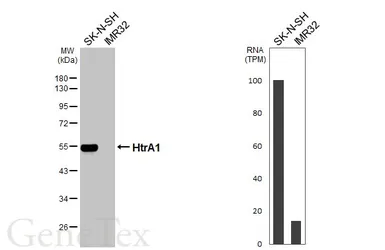 Anti-HtrA1 antibody [GT90] used in Western Blot (WB). GTX641981