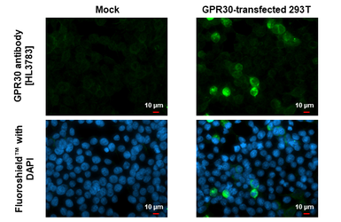 Anti-GPR30 antibody [HL3783] used in Immunocytochemistry/ Immunofluorescence (ICC/IF). GTX642002