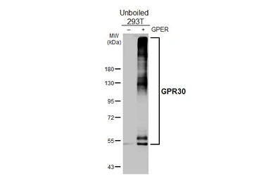 Anti-GPR30 antibody [HL3783] used in Western Blot (WB). GTX642002